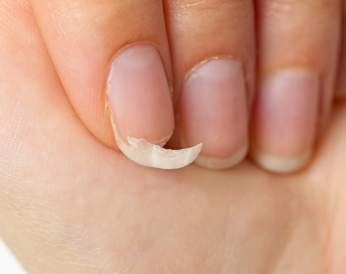 Como Tratar e Prevenir Unhas Quebradiças: Dicas Essenciais para Unhas Fortes e Saudáveis